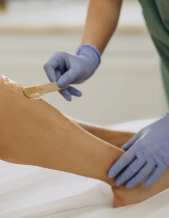 laser-epilation-hair-removal-therapy